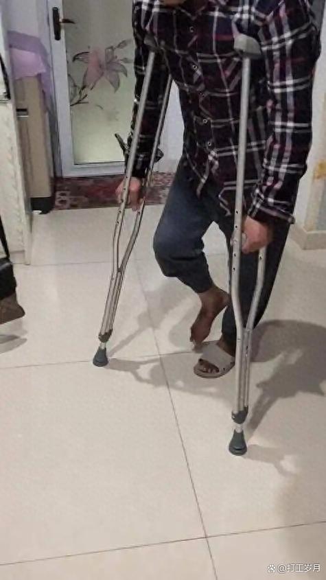 胫腓骨取钢板要拄拐吗缩略图