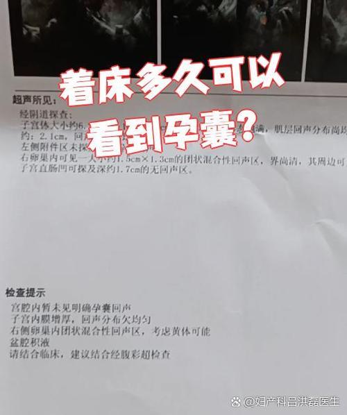 怀孕多久有孕囊图标