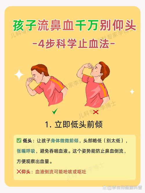 怎样才能快速流鼻血?