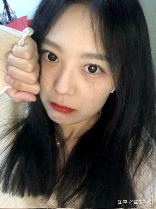 男生会嫌弃脸上有斑的女生吗图标