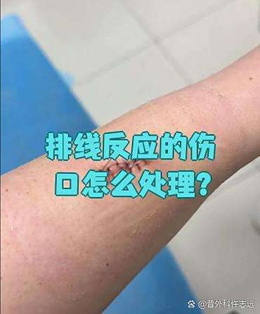 排线反应会自己愈合吗图标