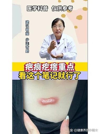 治疗疤痕疙瘩最好的方法