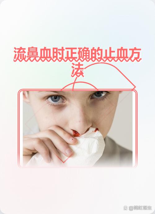 流鼻血正确的方法