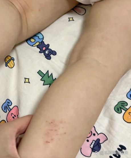 小儿利宝颗粒适合几岁孩子缩略图