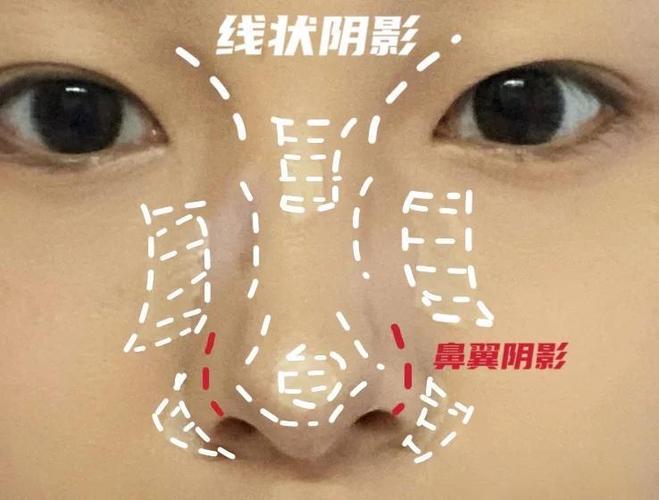 怎么样才能让鼻头鼻翼变小缩略图