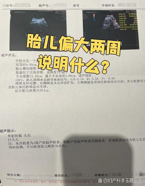 胎心少动是男孩女孩吗缩略图
