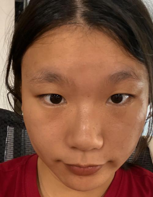 晒黑的皮肤怎么快速变白缩略图