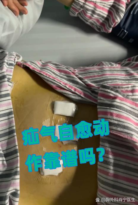 疝气锻炼的最好方法