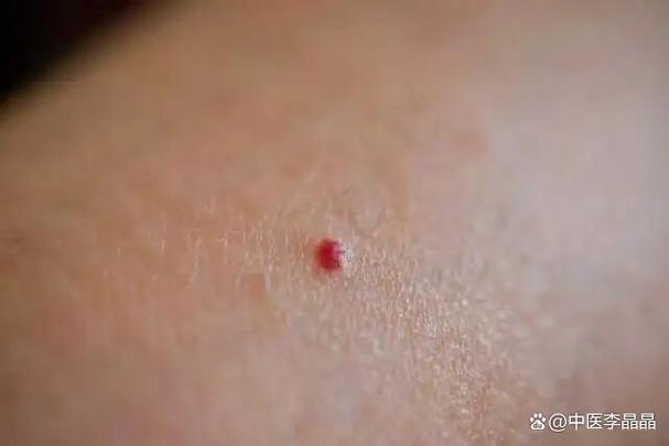 抖音消息红点删不除的原因是什么