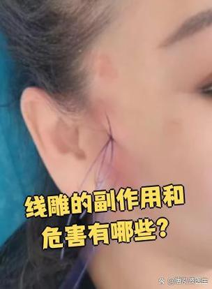 脸部线雕的副作用和危害