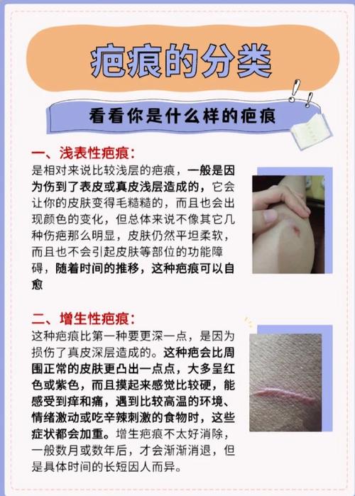 祛除疤痕的方法图标