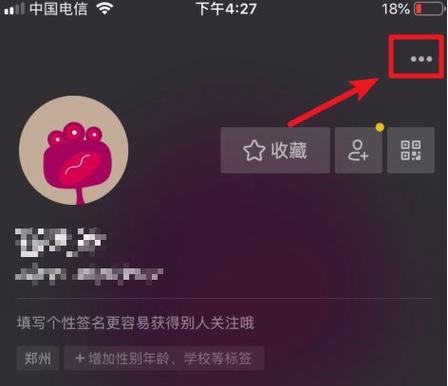 发抖音怎么去掉抖音号码缩略图