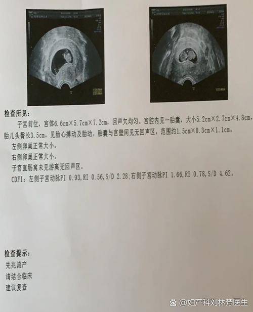 怀孕只见暗区不见孕囊图标