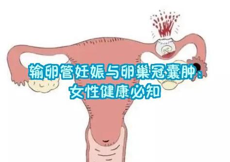 怎么看卵巢功能好不好图标