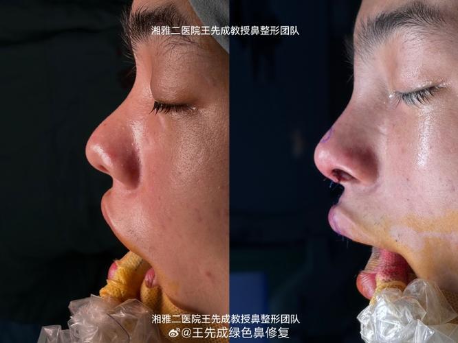 ps图片畸形矫正