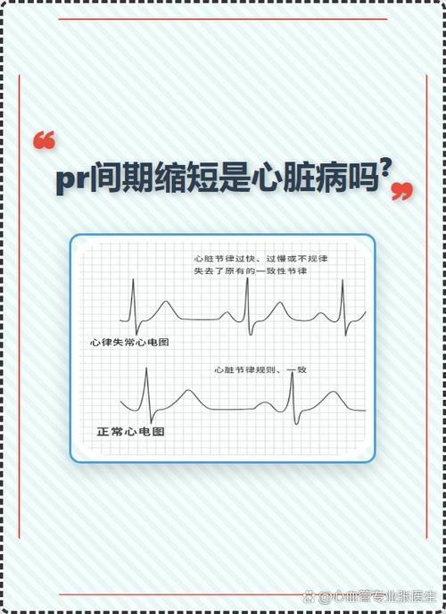 pr间期正常值范围是多少