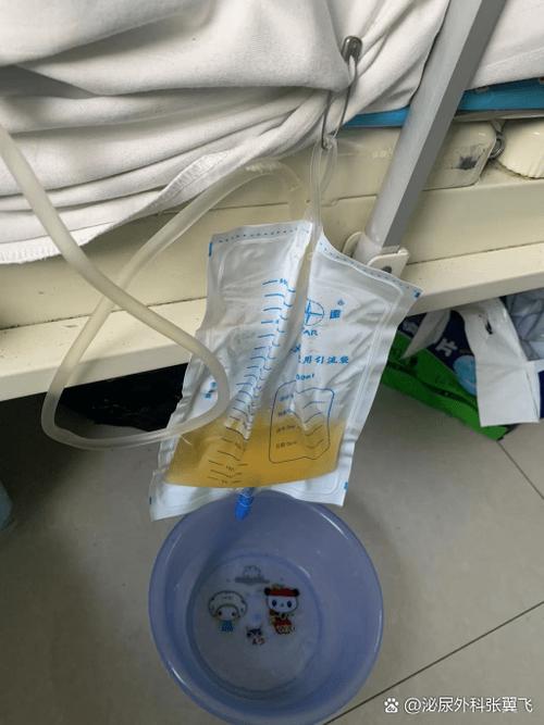羽毛笔尿孔被划入尿不出来怎么办