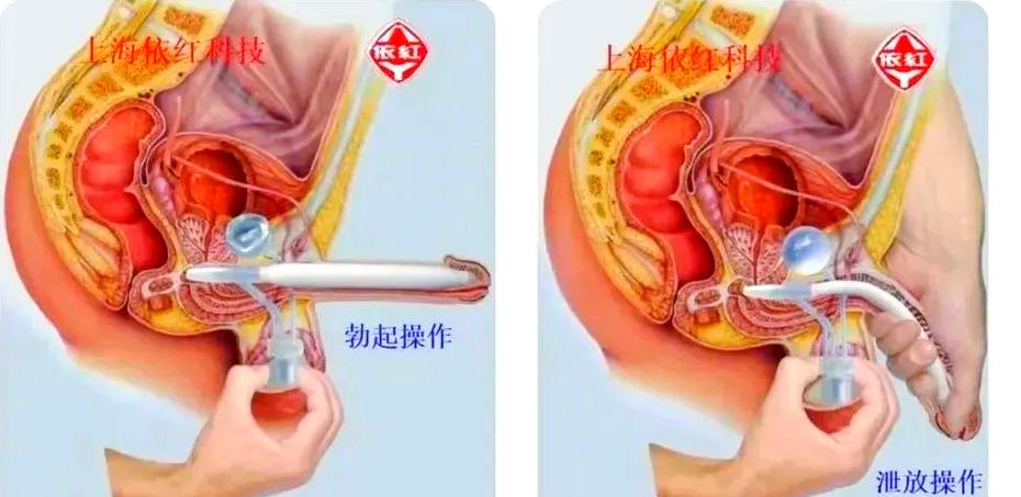 男友有生理需求了会有什么表现