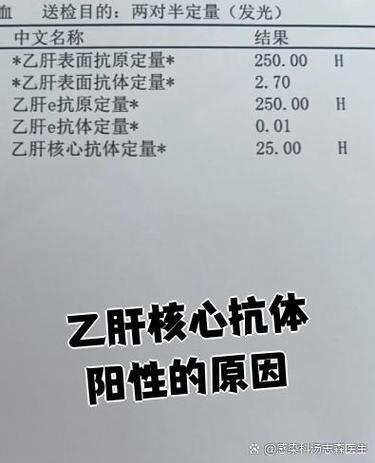 乙肝核心抗体阳性是什么意思缩略图