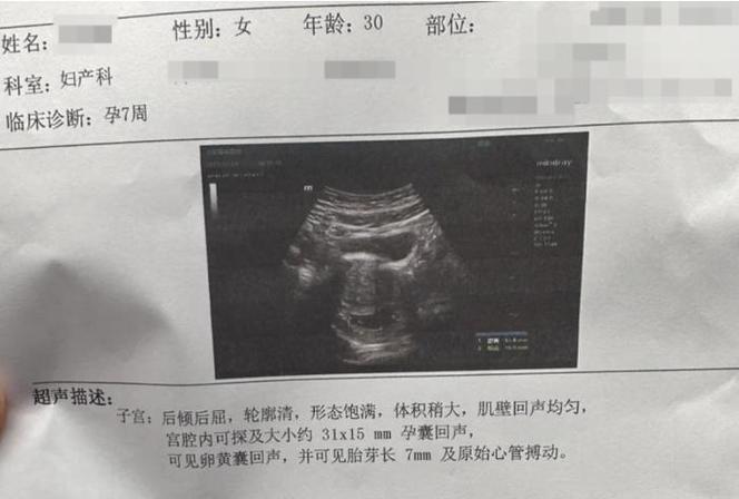 怀孕6周b超看不到胎囊原因图标