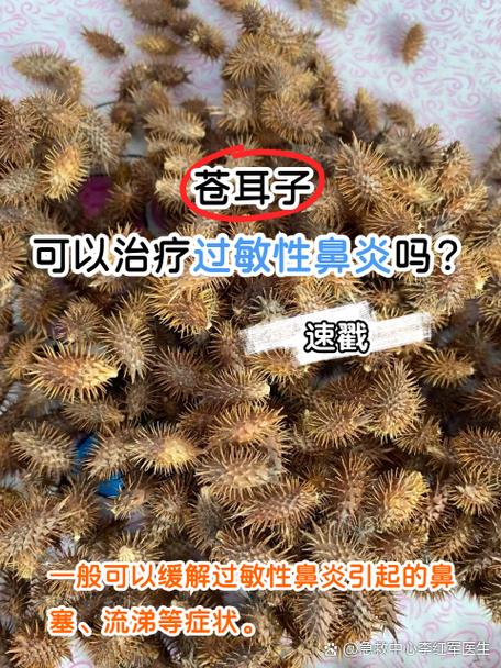 鼻炎怎么治疗彻底除根最快最有效