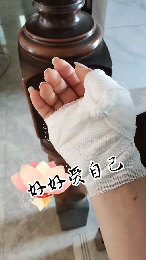适合手受伤发朋友圈的句子