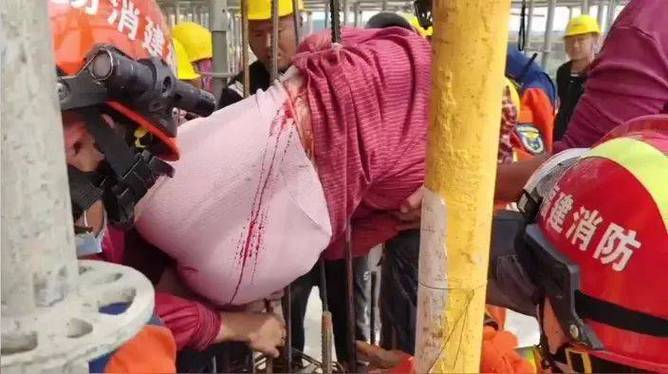 女子身体被钢筋刺穿腹部缩略图