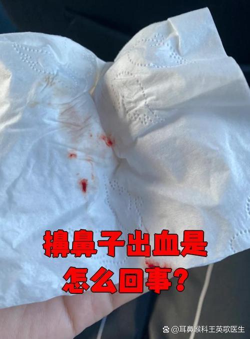 擤鼻涕有血还流鼻血图标