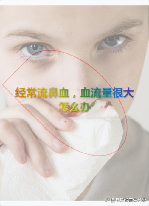 哺乳期妈妈上火流鼻血怎么办缩略图