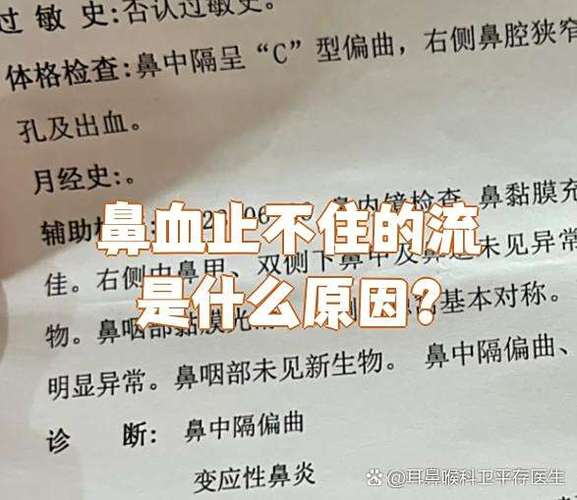 鼻血流的止不住是什么原因图标