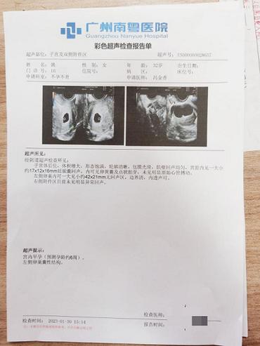 怀孕45天做b超只显示有小暗区图标