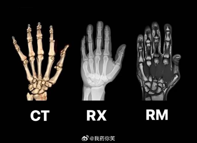xray检查是拍片还是CT游戏截图
