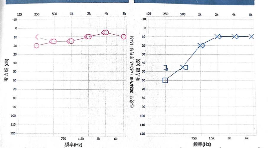 手机语音说话没有声音是什么原因缩略图