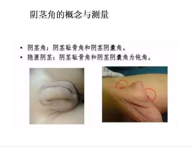 为什么相册没有的照片qq聊天页面有图标