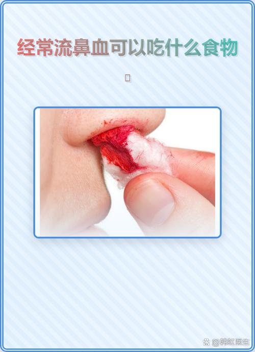 经常流鼻血吃什么好