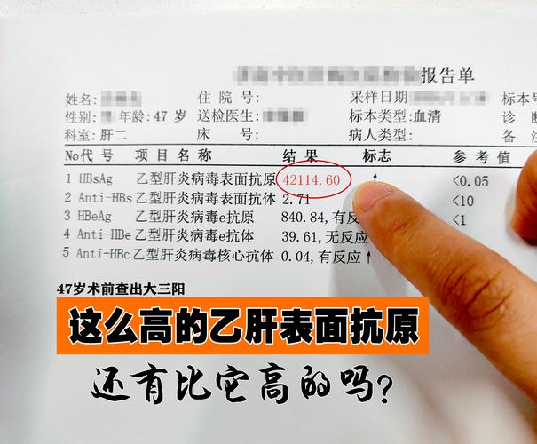 乙肝表面抗原多少算高