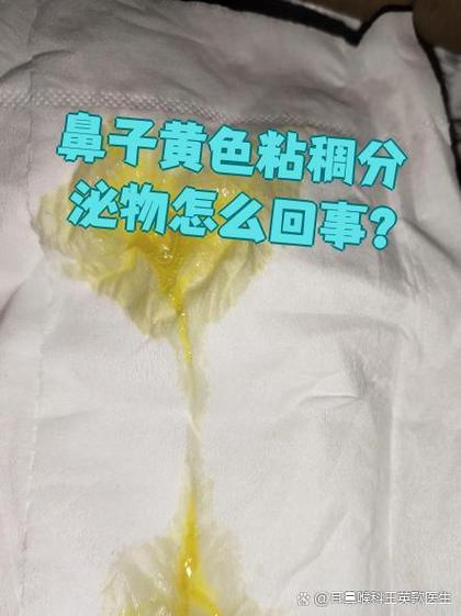感冒鼻子里有黄鼻涕还有血图标