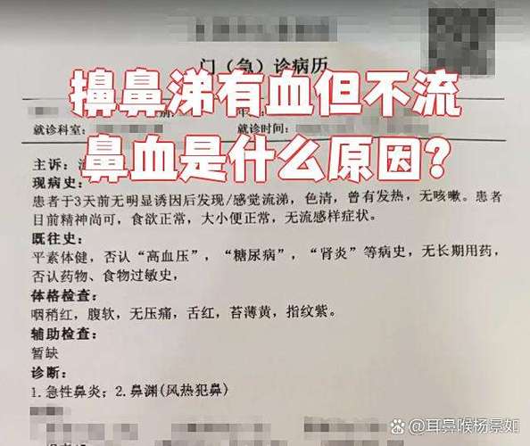 感冒了擤鼻涕有血但不流鼻血图标