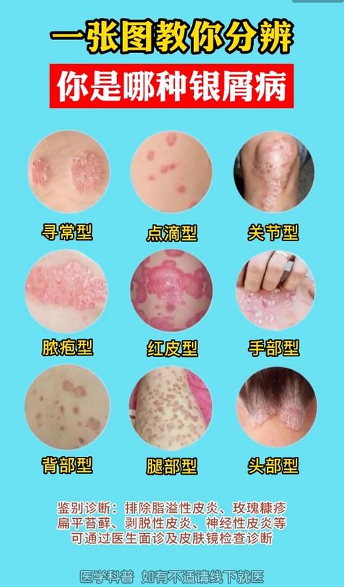 扫一扫识别皮肤病在线缩略图