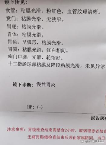 dpm值得和HP有什么区别缩略图