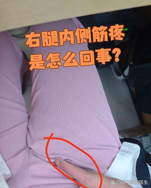 腿上的一根筋总是感觉难受图标