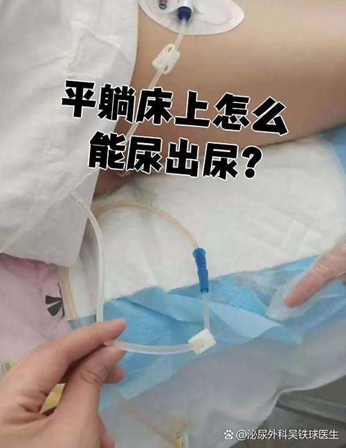 按压膀胱会尿出来吗图标