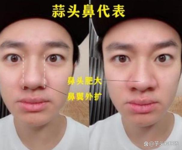 为什么捏鼻头鼻头会变大