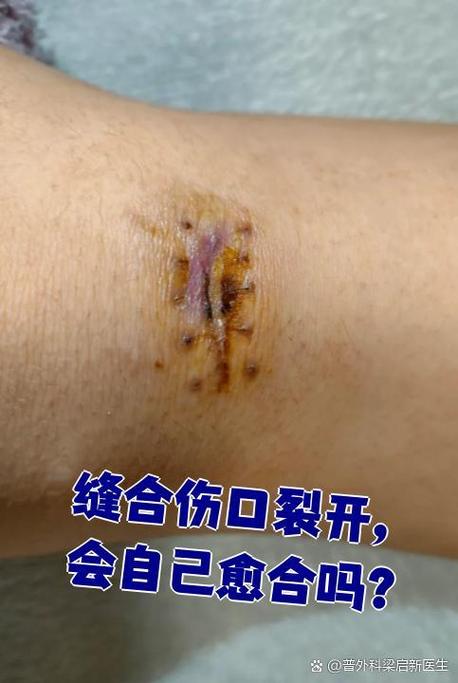 伤口会自己愈合吗图标