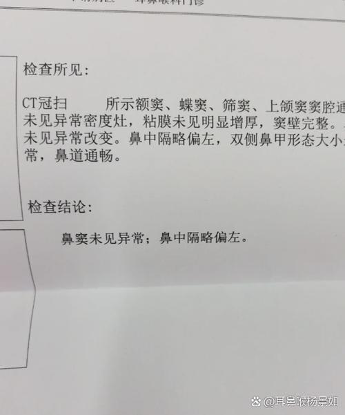 50岁一60岁流鼻血要警惕