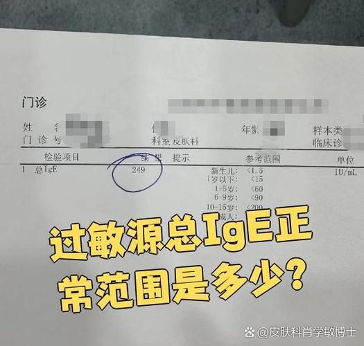 总ige正常值范围是多少缩略图