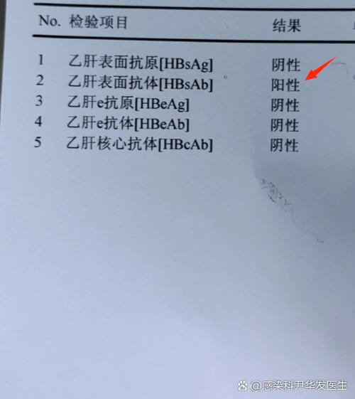 乙肝表面抗原1000多严重吗缩略图