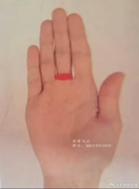 流鼻血中指绑上绳子真的能止血吗游戏截图