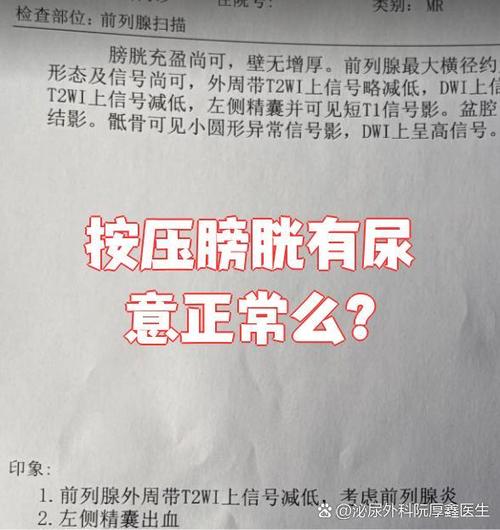 为什么挤压膀胱会有尿意图标