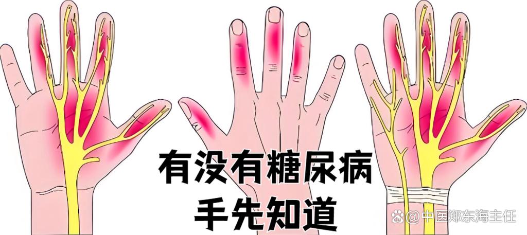 糖尿病刚开始是什么状态了图标